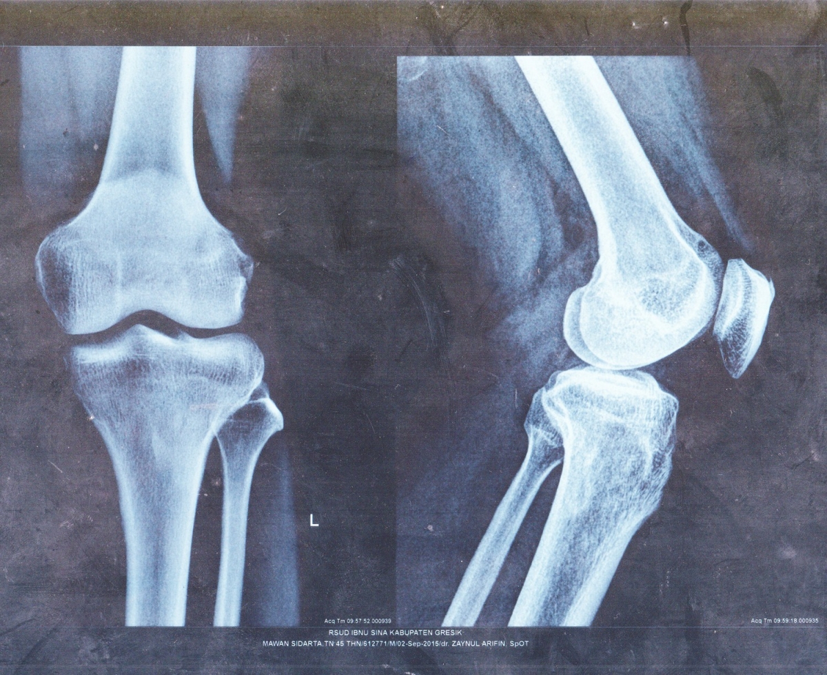 Ayolning ahmoqligi bor Ayollar yalangoch holda daryoda chomishadi