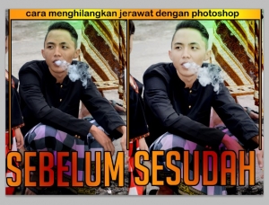 Tutorial Cara Menghilangkan Jerawat Di Photoshop Kompasiana Com