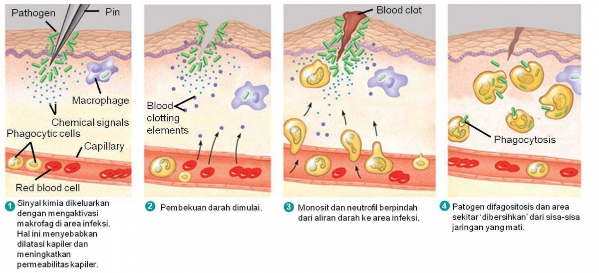 Kesalahan Obat Anti Inflamasi Halaman All Kompasiana Com