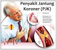 Ketahui Penyebab dan Gejala Penyakit Jantung Koroner  Ketahui Penyebab dan Gejala Penyakit Jantung Koroner