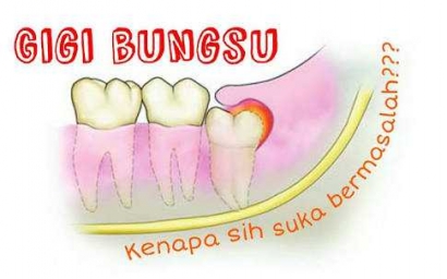 Pengalaman Tak Terlupakan Operasi Gigi Bungsu Pakai Jaminan Kesehatan Kompasiana Com