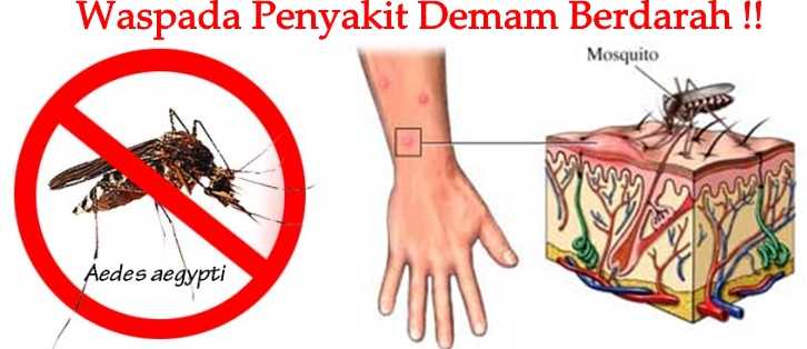 Hasil gambar untuk demam berdarah