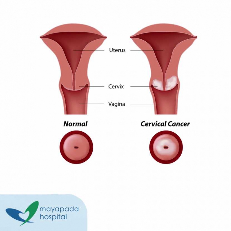 Xotinlar uyda strapon Murmansk viloyatida qiz bilan yaqinlik va jinsiy aloqa