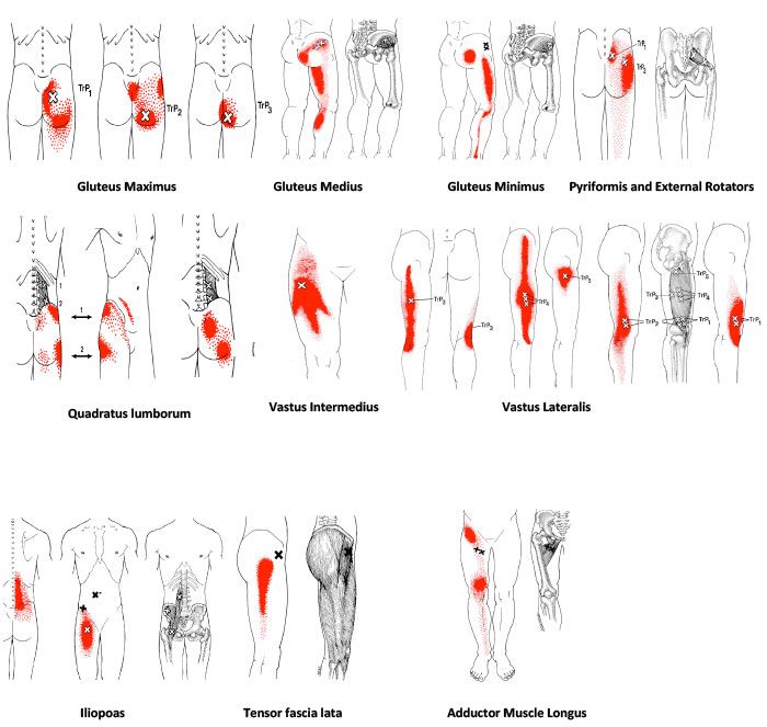 penyebab sakit kepala bagian belakang berkepanjangan Apa Penyebab Nyeri Punggung Bagian Bawah Kompasiana com penyebab sakit kepala bagian belakang berkepanjangan Apa Penyebab Nyeri Punggung Bagian Bawah Kompasiana com