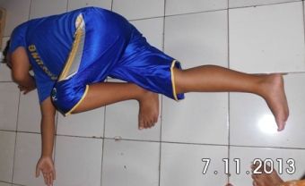 Cara Ampuh dan Mudah Mengatasi Perut Kembung dan Susah BAB