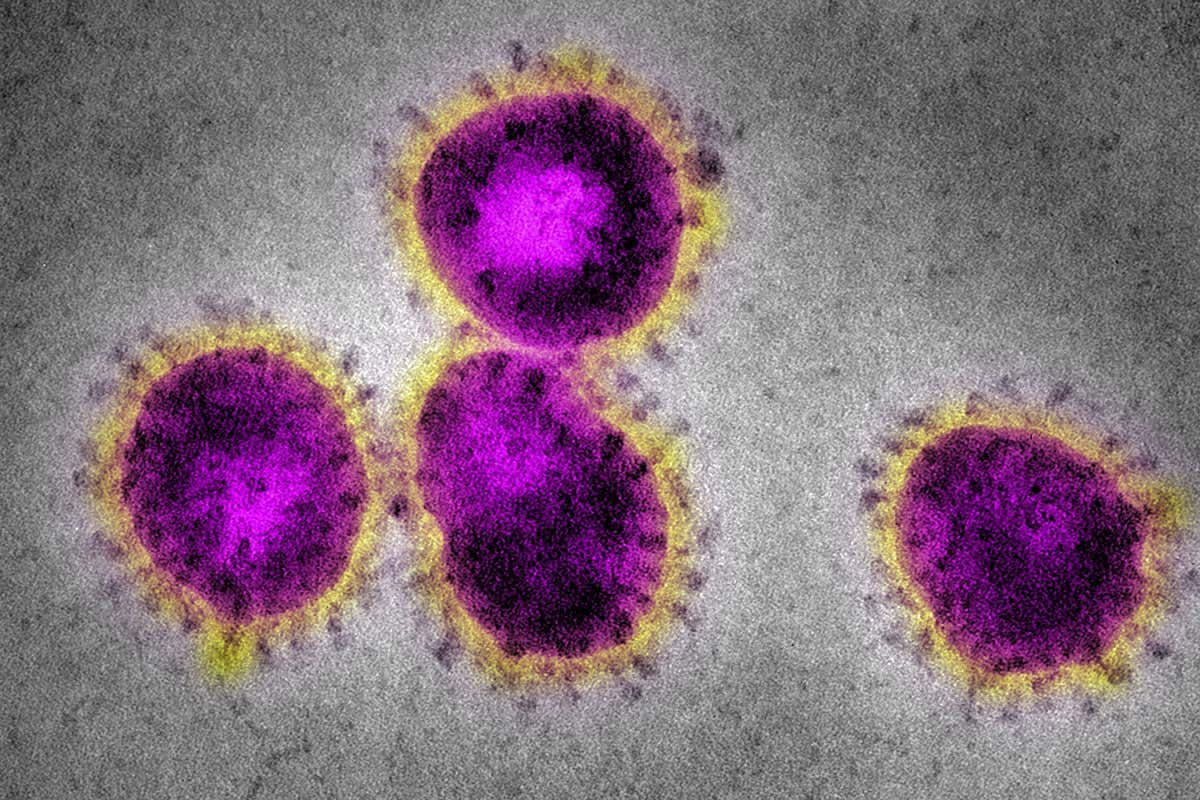 Коронавирус через цветы. Коронавирус SARS cov 2 под микроскопом. Коронавирус под микроскопом. Коронавирус в микроскопе. Атипичная пневмония (SARS).