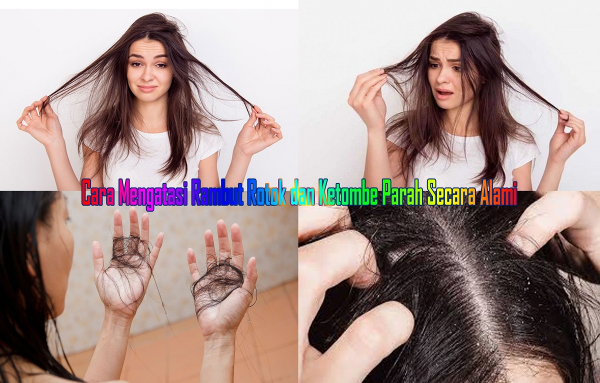 Faktor Penyebab Ketombe Dan Masalah Rambut Rontok Parah Kompasiana Com