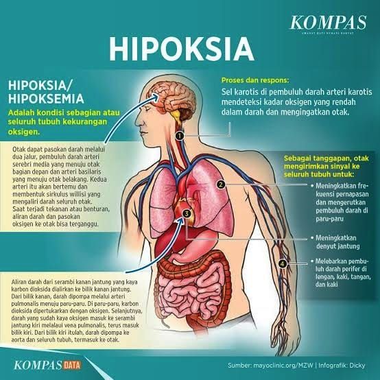 Hypoxia Dan Terpapar Covid 19 Halaman 1 Kompasiana Com