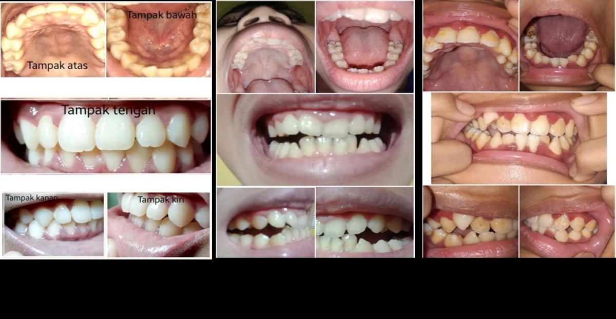 Seri 2 Gigi  dan Gusi Sehat  DiRumahAja Duh Gigiku Ada  Seri 2 Gigi  dan Gusi Sehat  DiRumahAja Duh Gigiku Ada
