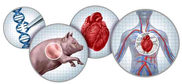 China Sukses Transplantasi 1 Paru-paru Babi ke Manusia 4 China Sukses Transplantasi 1 Paru-paru Babi ke Manusia