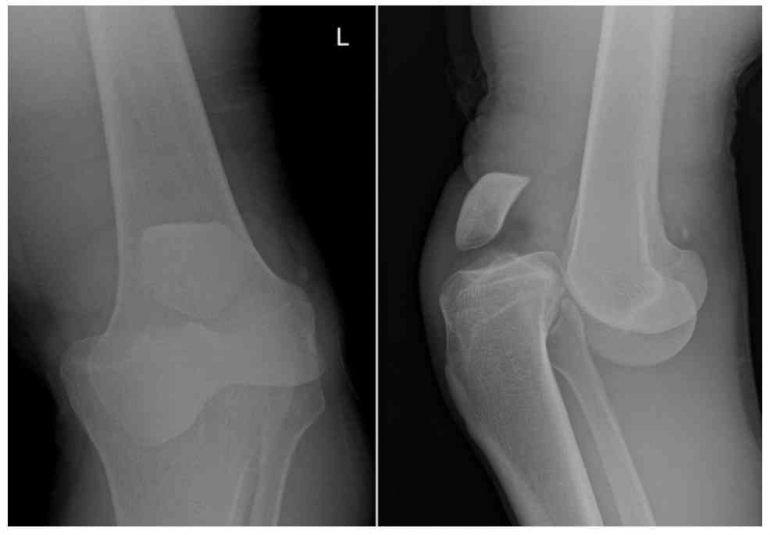 Anusda juda kop sperma Guruh jinsiy erotika