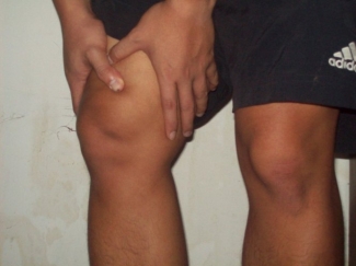 Sakit Lutut Asam Urat Atau Rematik Atau Apa Kompasiana Com