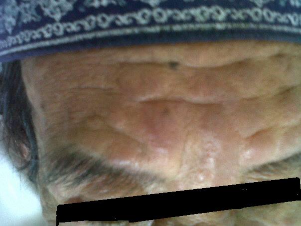 Terpaksa Konsultasi Pribadi Ke Dokter Spesialis Kulit Dan