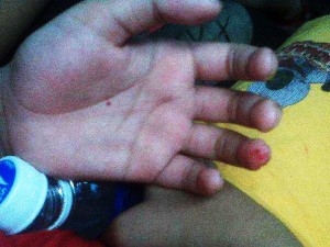 Darah Gambar  Tangan  Berdarah Asli Pedro gambar 