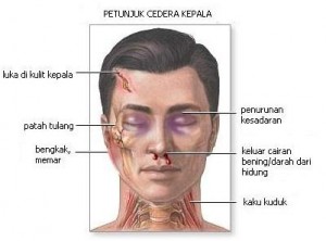 Hati Hati Jika Cedera Kepala Kompasiana Com